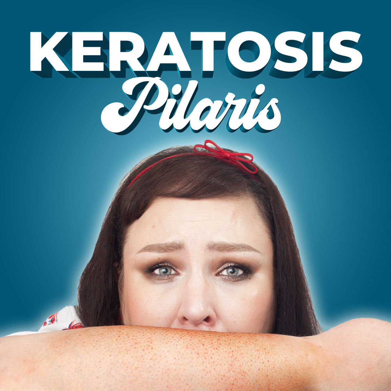 Keratosis Pilaris Reibeisenhaut KP Was hilft gegen rote Pickelchen auf Armen und Beinen Peeling Urea AHA BHA