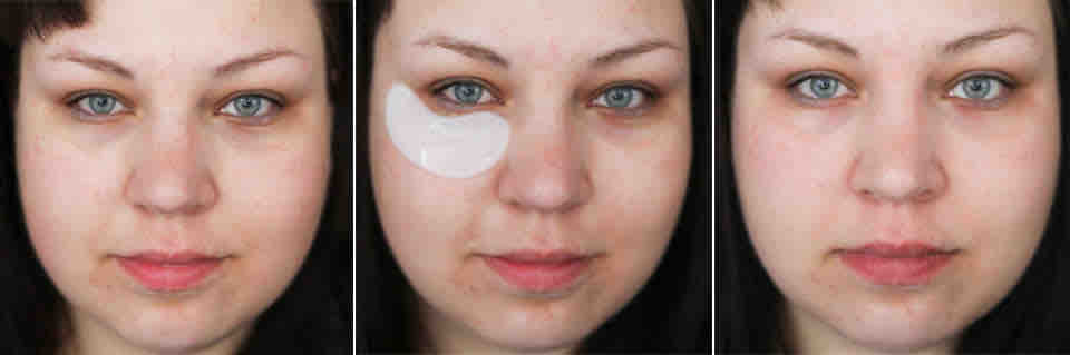 ANATOMICALS Puffy the Eye Bag Slayer Wake-up Under Eye Patches vorher nachher