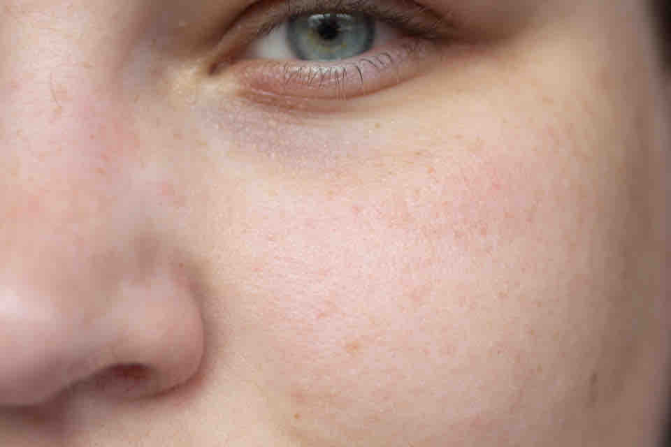 PAUL & JOE Bonbon Pearl Foundation Primer - Wange vorher