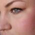 …und was war nun mit ‚Pink Melon‘?